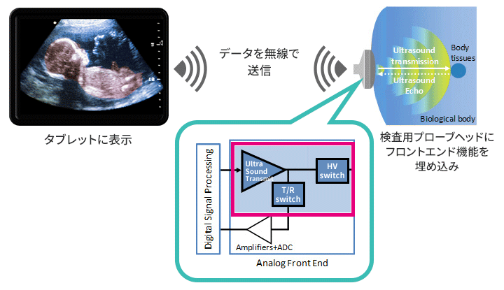 図4 ポータブル型超音波診断装置（イメージ図）